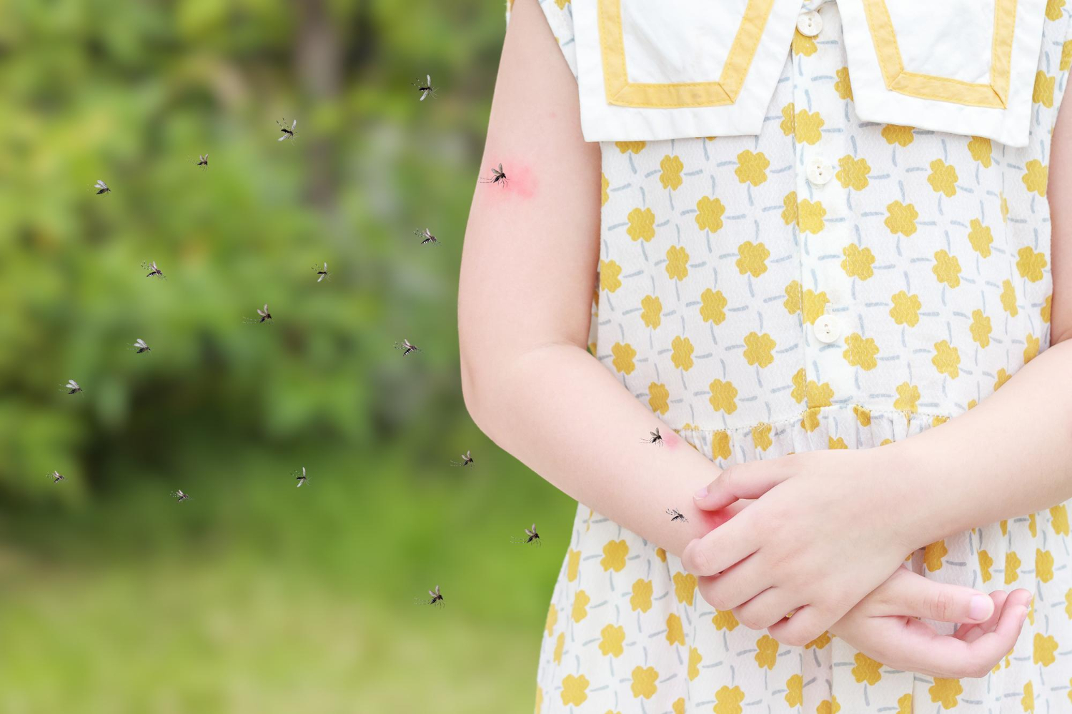 7 Effective Tips To Treat Mosquito Bites In Children EuroKids