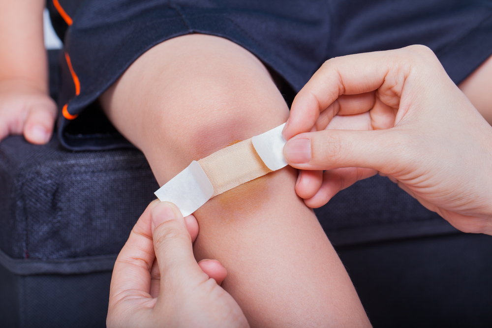 A No-Panic Guide to Treating Your Child's Cuts and Bruises