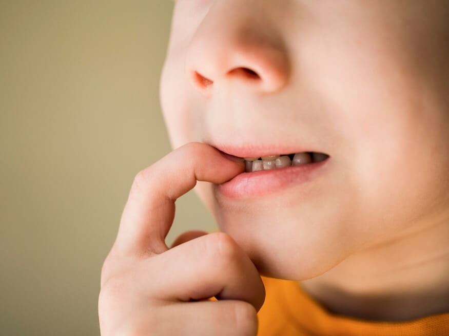 Effective Methods to Stop Nail Biting in Children